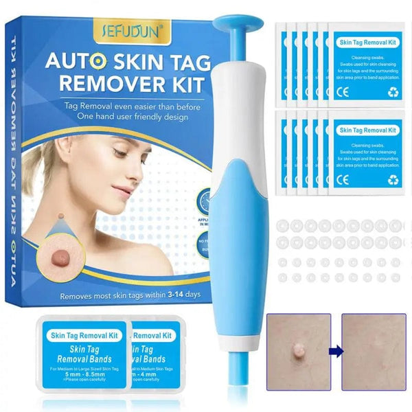 JackedDeals 2 In1 Painless Auto Skin Tag Mole Wart Removal Kit