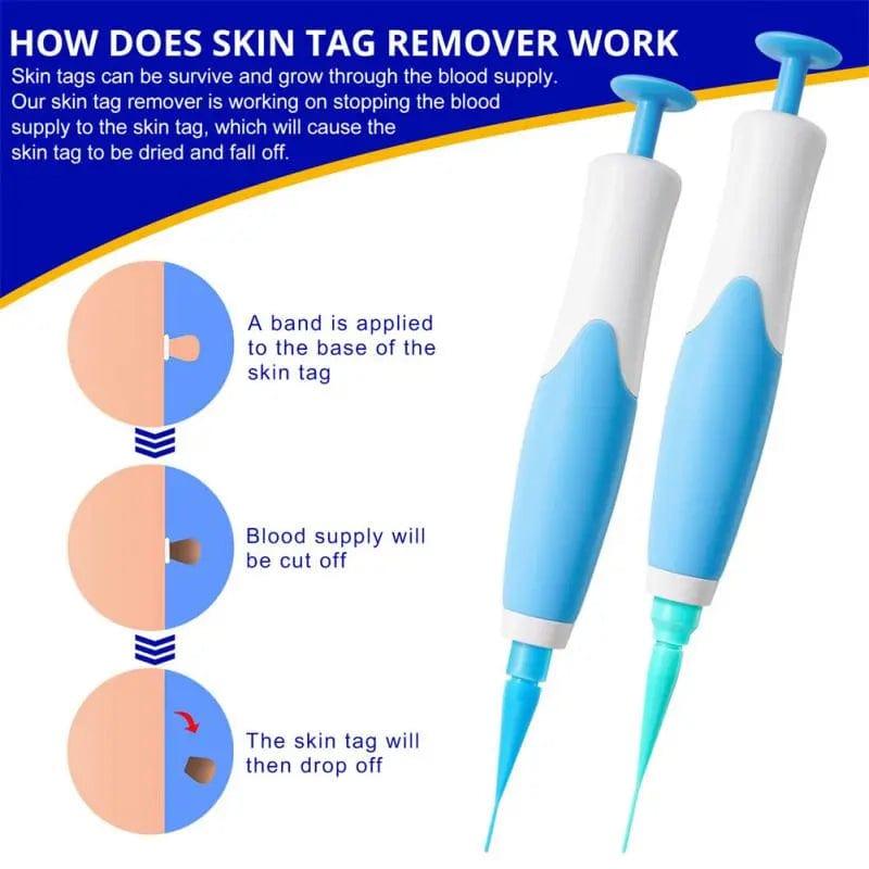 2 In1 Painless Auto Skin Tag Mole Wart Removal Kit - JackedDeals